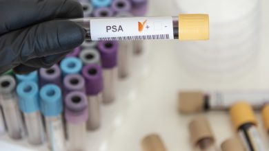 Urologista Goiânia - PSA substitui o exame de toque?