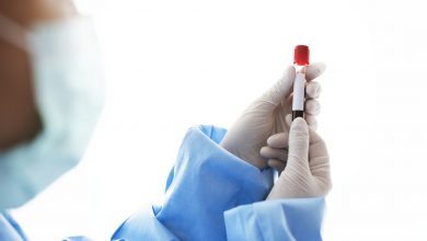 Urologia Goiânia - Você já fez exame de PSA?