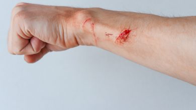 Pronto Socorro para Queimaduras - Tipos de tecidos encontrados em uma lesão