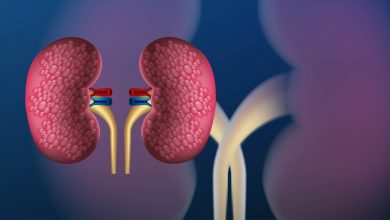 Urologia Goiânia - Cirurgia robótica no tratamento de câncer renal