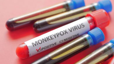 Portal Dicas de Saúde - Anvisa autoriza uso emergencial de kits para varíola dos macacos
