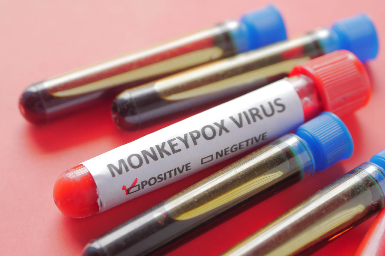 Portal Dicas de Saúde - Anvisa autoriza uso emergencial de kits para varíola dos macacos