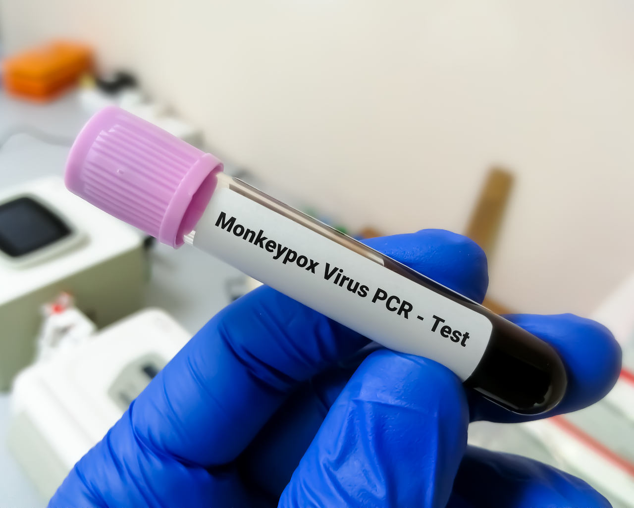 Portal Dicas de Saúde - Notificação de casos da varíola dos macacos passa a ser obrigatória