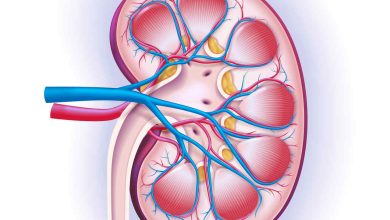 Urologia Goiânia - Fique atento ao sangue na urina! Pode ser câncer de rim!