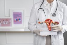 Centro de Imagem Aparecida de Goiânia - A importância da ultrassonografia no diagnóstico de mioma uterino