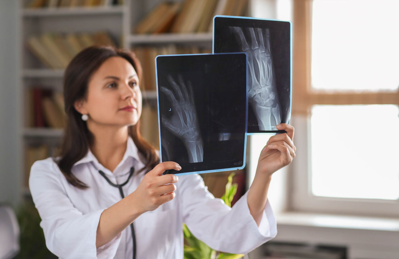 Centro de Imagem Aparecida de Goiânia - Principais vantagens da radiologia digital