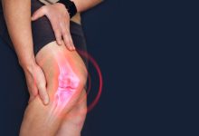 Ortopedia Goiânia - Afinal dá para conviver com ligamento do joelho rompido?