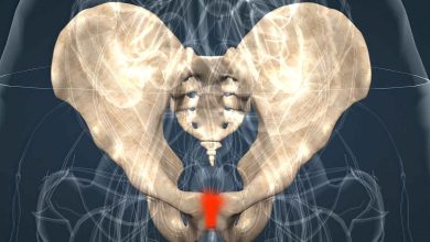 Ortopedia Goiânia - Conheça as causas e sintomas da pubalgia