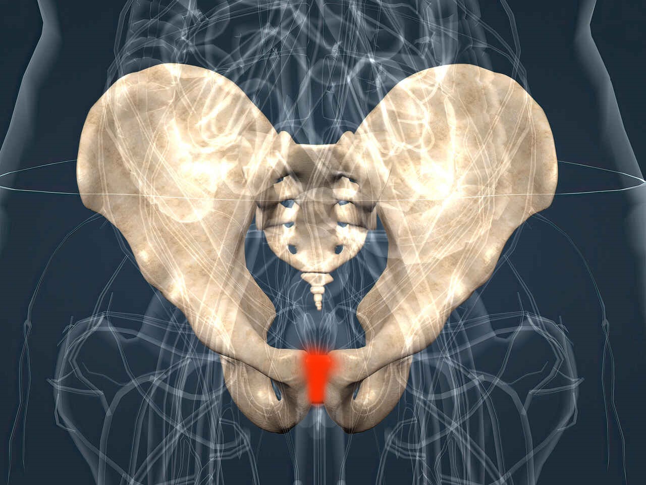 Ortopedia Goiânia - Conheça as causas e sintomas da pubalgia