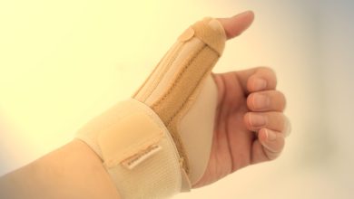 Ortopedia Goiânia - Luxação de dedo da mão