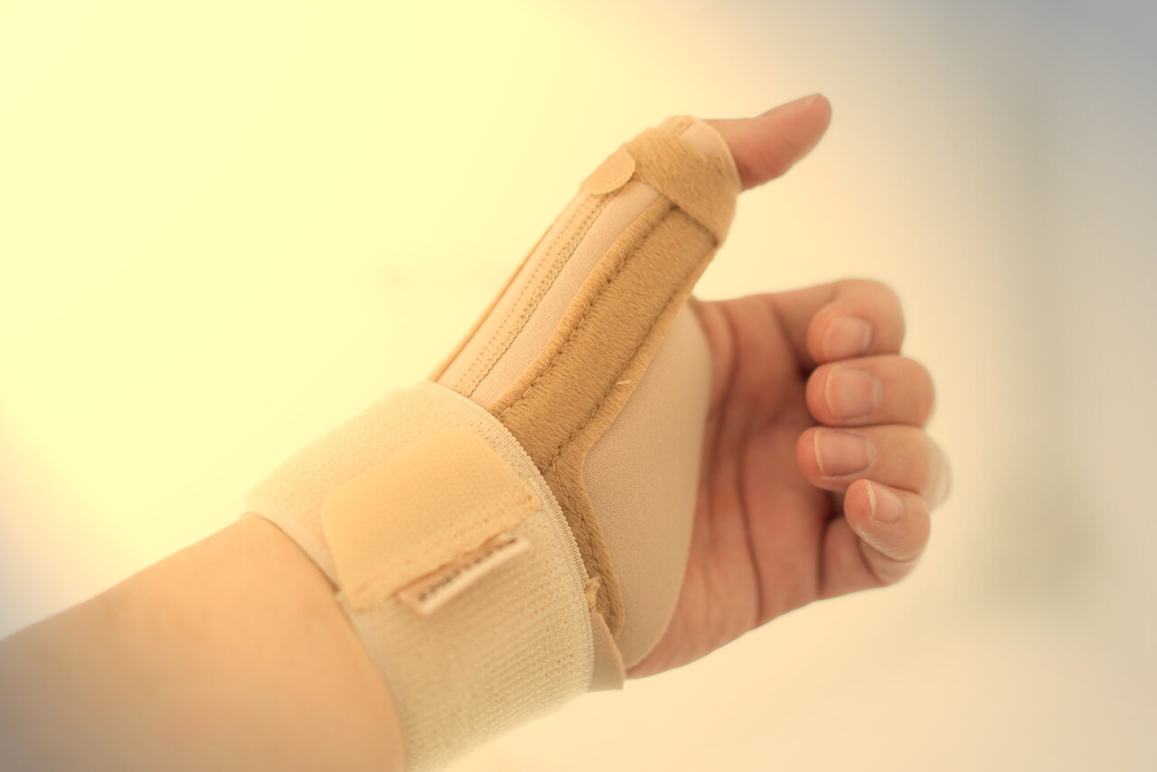 Ortopedia Goiânia - Luxação de dedo da mão