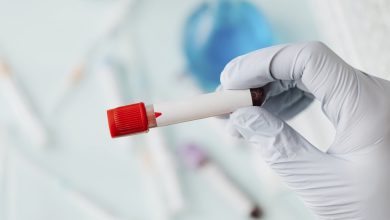 Novas regras para licenciamento de irradiação de sangue e hemocomponentes