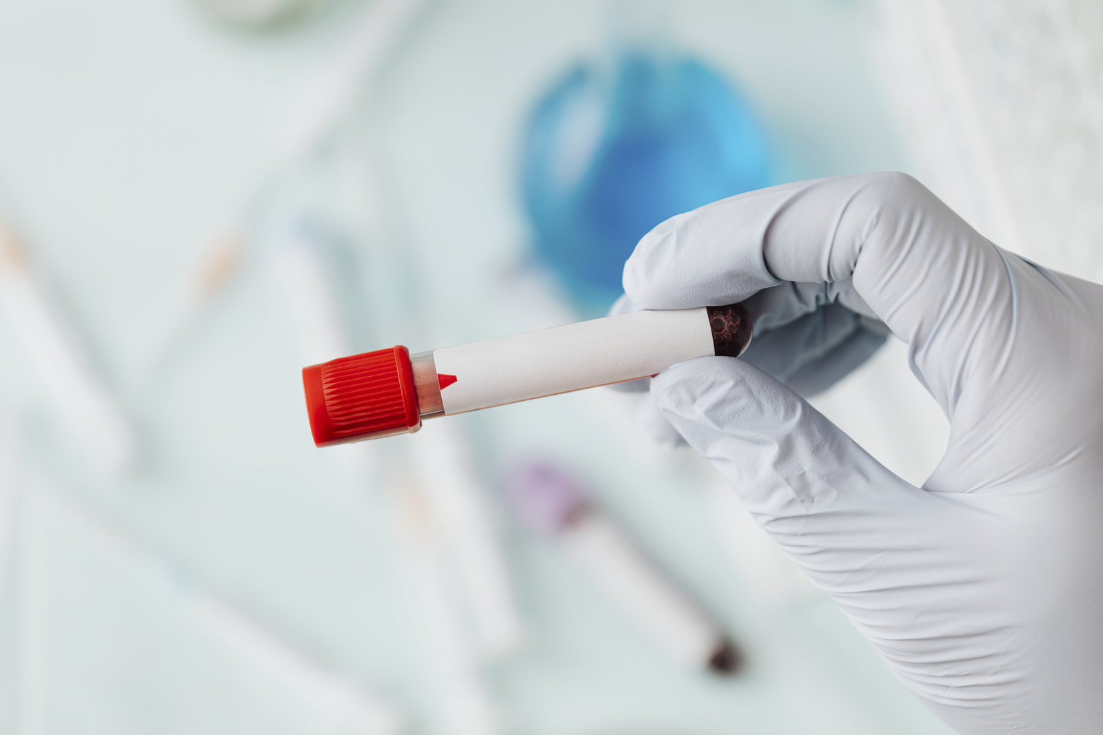 Novas regras para licenciamento de irradiação de sangue e hemocomponentes