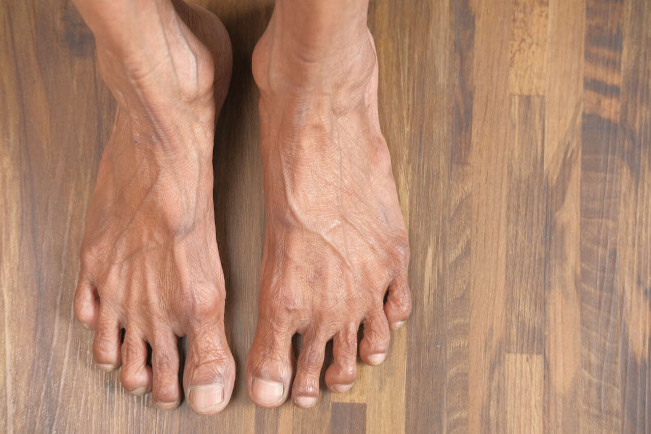 8 - Cuidados essenciais a ter com os pés dos idosos