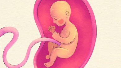 Dr João Batista Goiânia - Saiba o que é descolamento de placenta quais e quais são os sintomas