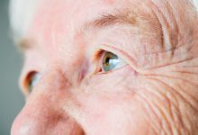 85 mil brasileiros fizeram cirurgia para glaucoma entre 2019 e 2023
