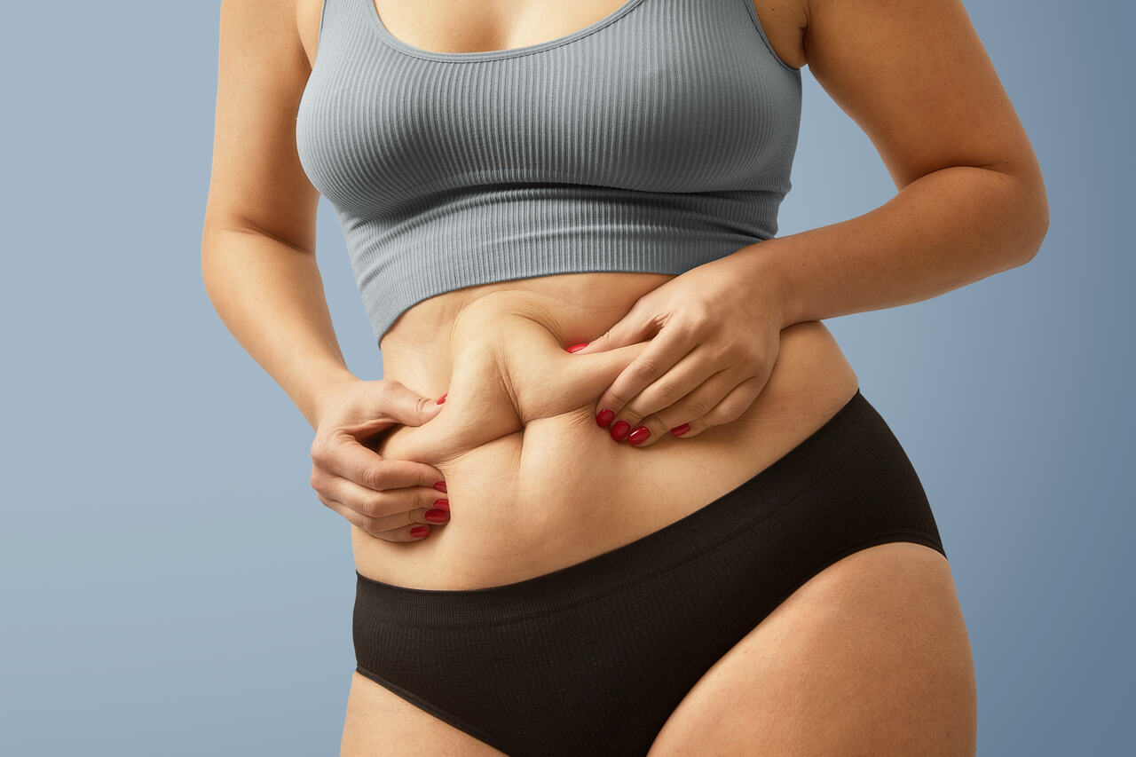 Goiânia: Dr. Marcelo Soares - Quem é o candidato ideal para Abdominoplastia?