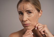 Dr. Reyner Abrantes Stival - Quais as vantagens de combinar ritidoplastia e blefaroplastia?