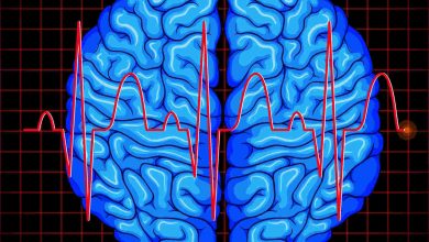Aneurisma cerebral doença silenciosa exige cuidados com a saúde