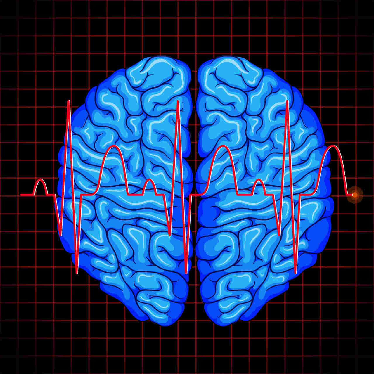 Aneurisma cerebral doença silenciosa exige cuidados com a saúde
