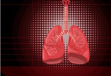 Tomografia computadorizada: exame altamente eficaz no diagnóstico de embolia pulmonar!