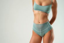 Cirurgião plástico especializado em Lipoaspiração: Quais são as coisas você precisa saber antes de fazer a Lipoescultura!