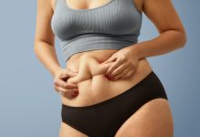 Posso fazer abdominoplastia mais de uma vez?