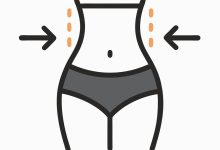 Cirurgião plástico especialista em abdominoplastia: O umbigo é reposicionado durante a abdominoplastia?