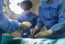 Cirurgião plástico Goiânia: O que é a seroma, e como ela pode ser prevenida ou tratada após a cirurgia?
