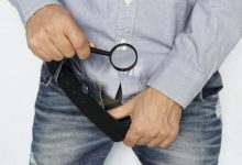 Você tem fimose? Fique atento e saiba quando é preciso operar!