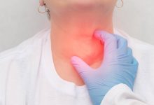 Fui diagnosticado com nódulo na tireoide, preciso fazer punção guiada por USG?