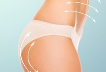 É possível realizar abdominoplastia e enxerto de gordura nos glúteos ao mesmo tempo?