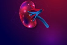 Nefrectomia parcial: Qual é a melhor opção?