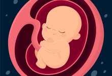 5 dicas que pode ajudar na Restrição de Crescimento Intrauterino (RCIU)