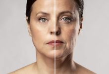 A flacidez facial tem impactado sua autoestima Descubra o poder do Lifting Facial!