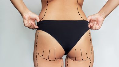 Lipoescultura não é só para definir o abdômen!