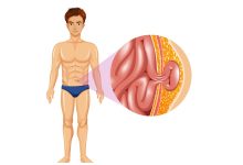 Como identificar hérnia umbilical e quando operar
