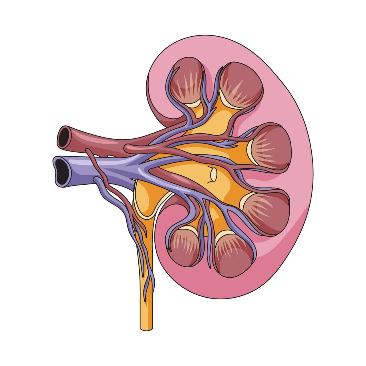 Nefrolitotripsia Percutânea o que é e quando é indicada