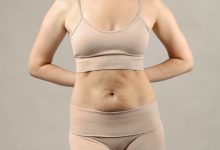 5- Quer se livrar da barriguinha indesejada Conheça a miniabdominoplastia!