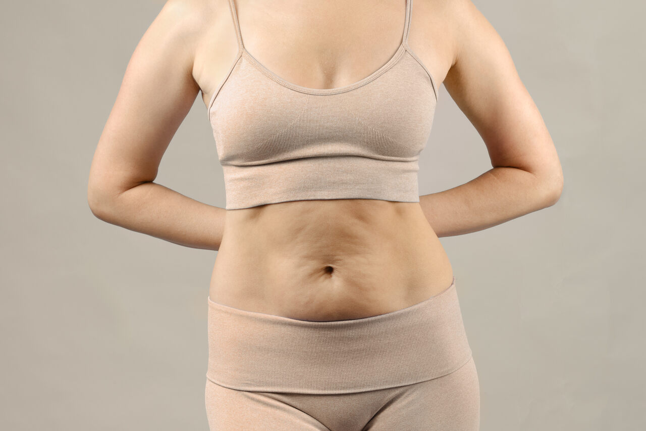 5- Quer se livrar da barriguinha indesejada Conheça a miniabdominoplastia!
