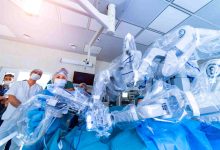 Cirurgia robótica é indicada só para câncer de próstata Especialista explica quando ela pode ser utilizada