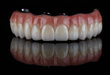 Diga adeus a dentatura com a prótese protocolo!