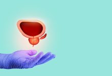 Saúde do homem Dr. Marco Túlio Cruvinel, urologista em Goiânia, explica as vantagens do HoLEP para tratar o aumento da próstata