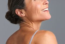 Conheça as áreas de aplicação do botox!