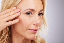 Mitos e verdades sobre a blefaroplastia