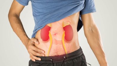 O que fazer para aliviar a dor da cólica renal