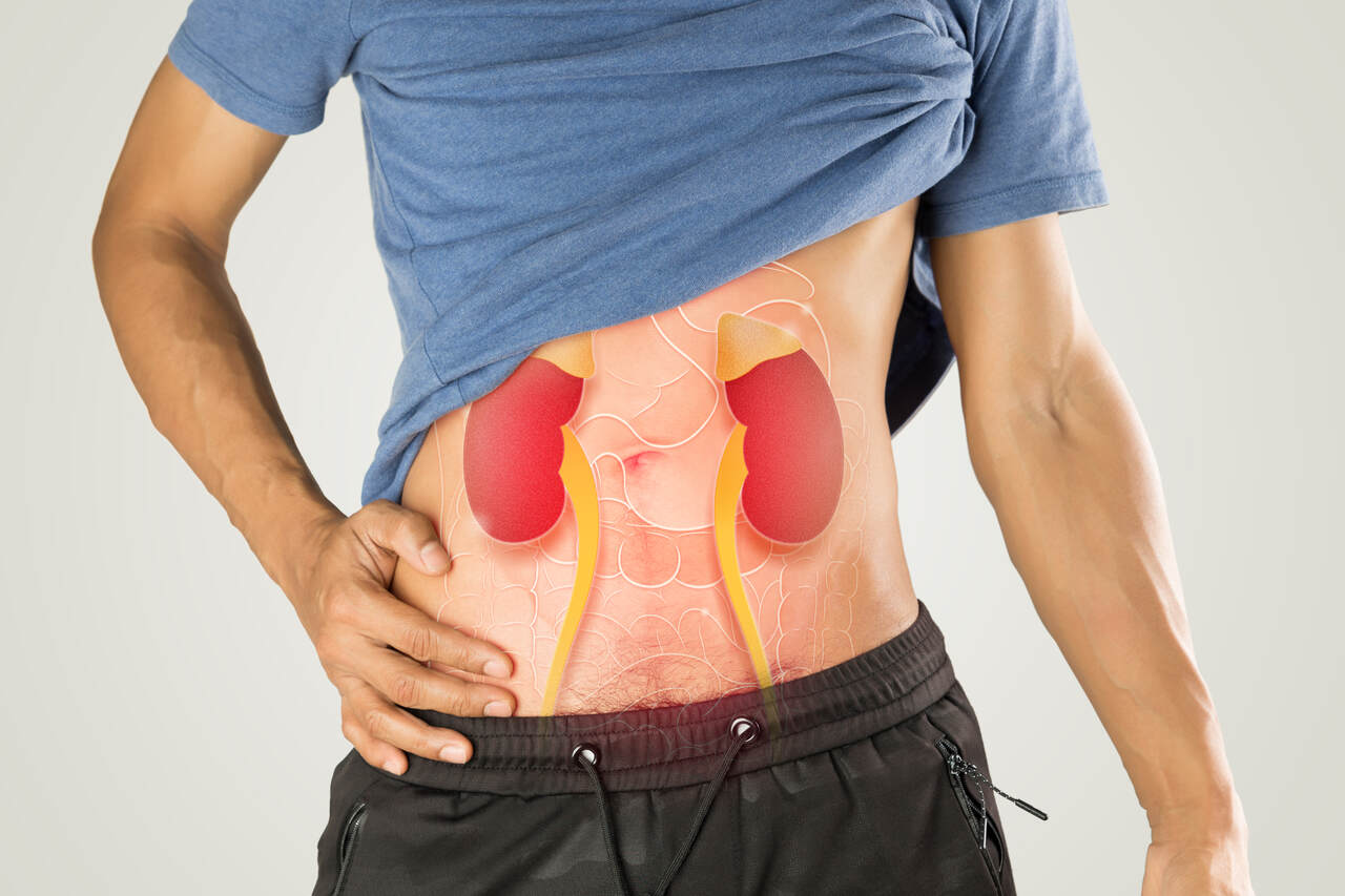 O que fazer para aliviar a dor da cólica renal