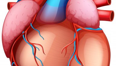 Quando a aterosclerose exige cirurgia?