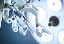 Como a cirurgia robótica transforma a revascularização do miocárdio