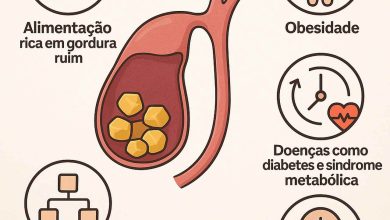 5 causas da pedra na vesícula que você precisa conhecer agora!